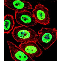 Ewing Sarcoma Breakpoint Region 1 (EWSR1) Antibody