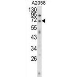 Ewing Sarcoma Breakpoint Region 1 (EWSR1) Antibody