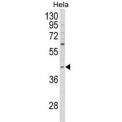 Cytoplasmic Protein NCK1 (NCK1) Antibody