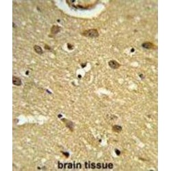 Ubiquitin-Associated Protein 1 (UBAP1) Antibody