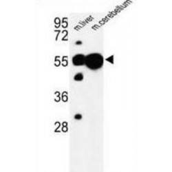 Ubiquitin-Associated Protein 1 (UBAP1) Antibody