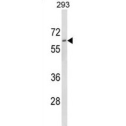 Dolichol Kinase (DOLK) Antibody