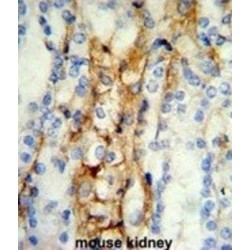 Mitofusin-2 (MFN2) Antibody