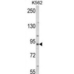 Mitofusin-2 (MFN2) Antibody