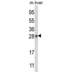 Quinoid Dihydropteridine Reductase (QDPR) Antibody