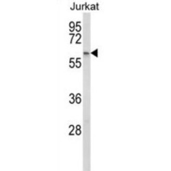 Propionyl-CoA Carboxylase Beta Chain, Mitochondrial (PCCB) Antibody