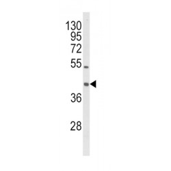 Oxidized Low Density Lipoprotein Receptor 1 (OLR1) Antibody