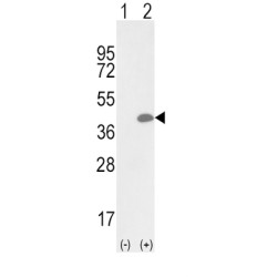 Oxidized Low Density Lipoprotein Receptor 1 (OLR1) Antibody