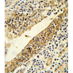 Lanosterol 14-Alpha Demethylase (CYP51A1) Antibody