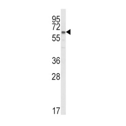 Lanosterol 14-Alpha Demethylase (CYP51A1) Antibody