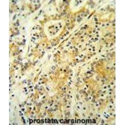 Microsomal Glutathione S Transferase 2 (MGST2) Antibody