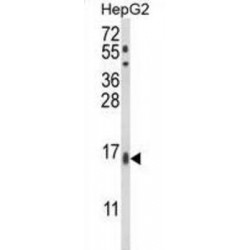 Microsomal Glutathione S Transferase 2 (MGST2) Antibody