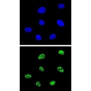 Tumor Protein P73 (TP73) Antibody
