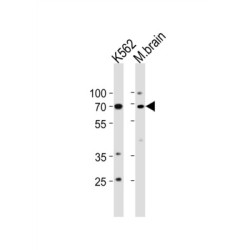 Tumor Protein P73 (TP73) Antibody