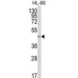 Beta-1,4-Galactosyltransferase 1 (B4GALT1) Antibody