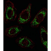 Ornithine Aminotransferase, Mitochondrial (OAT) Antibody