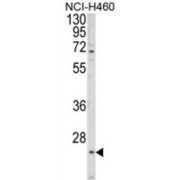 WB analysis of NCI-H460 cell line lysates.