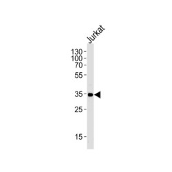 Fc Fragment of IgG, Low Affinity IIa, Receptor / CD32 (FCGR2A) Antibody