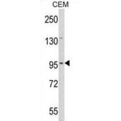 Zinc Finger Protein DZIP1 (DZIP1) Antibody