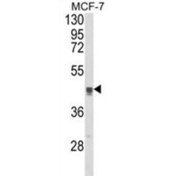 Trans Golgi Network Protein 2 (TGOLN2) Antibody