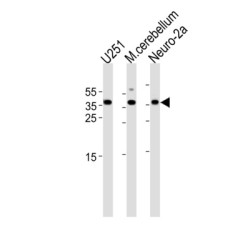 Empty Spiracles Homeobox 1 (EMX1) Antibody