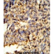 Fc Fragment of IgG, Low Affinity IIc, Receptor For (CD32) (FCGR2C) Antibody