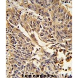 Junction Plakoglobin (JUP) Antibody