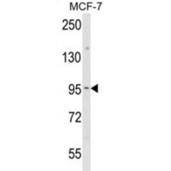 Junction Plakoglobin (JUP) Antibody