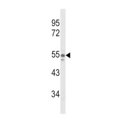 Nicotinamide Phosphoribosyltransferase (NAMPT) Antibody