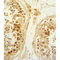 Secreted Frizzled Related Protein 1 (SFRP1) Antibody