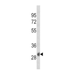 Secreted Frizzled Related Protein 1 (SFRP1) Antibody