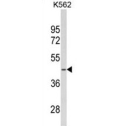 L-Serine Dehydratase/L-Threonine Deaminase (SDS) Antibody