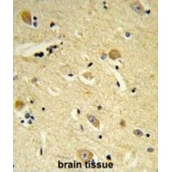 CDP-Diacylglycerol-Inositol 3-Phosphatidyltransferase (CDIPT) Antibody