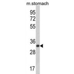 CDP-Diacylglycerol-Inositol 3-Phosphatidyltransferase (CDIPT) Antibody