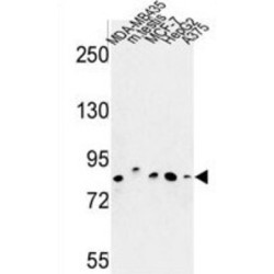 Chondroitin Polymerizing Factor (CHPF) Antibody