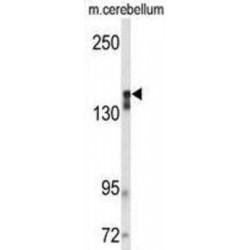 Vascular Endothelial Growth Factor Receptor 2 (VGFR2) Antibody