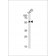 Cytochrome P450 27B1 (CYP27B1) Antibody