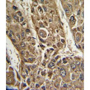 Microsomal Triglyceride Transfer Protein (MTTP) Antibody