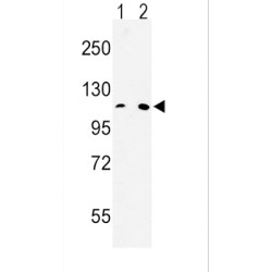 Microsomal Triglyceride Transfer Protein (MTTP) Antibody