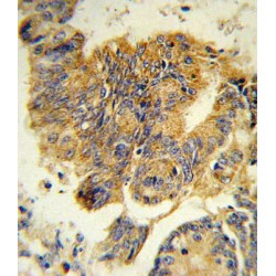 Colony Stimulating Factor Receptor, Granulocyte (CSF3R) Antibody