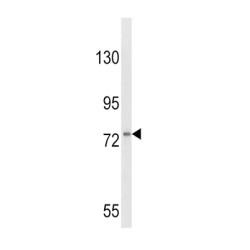 Colony Stimulating Factor Receptor, Granulocyte (CSF3R) Antibody