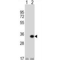 Glutamate Cysteine Ligase, Modifier Subunit (GCLM) Antibody