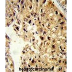 Pterin-4 Alpha-Carbinolamine Dehydratase 1 (PCBD1) Antibody