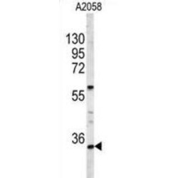 Homeobox Protein Hox-A9 (HOXA9) Antibody