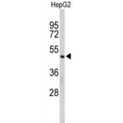 CASP8 And FADD Like Apoptosis Regulator (CFLAR) Antibody