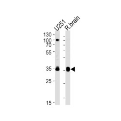 Guanine Nucleotide Binding Protein (G Protein), Alpha Activating Activity Polypeptide O (GNAO1) Antibody