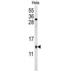 Cytochrome C Oxidase Subunit 5A (COX5A) Antibody