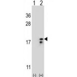 Cytochrome C Oxidase Subunit 6A1 (COX6A1) Antibody