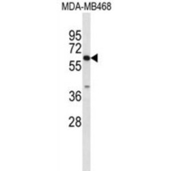 Carboxylesterase 5A (CES5A) Antibody