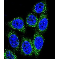 MutY Homolog (MUTYH) Antibody